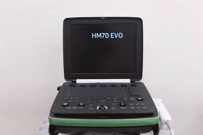 超音波画像診断装置