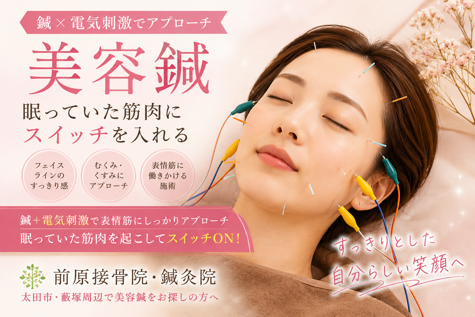 美容鍼で「眠っていた筋肉」にスイッチを。前原接骨院・鍼灸院の美容鍼